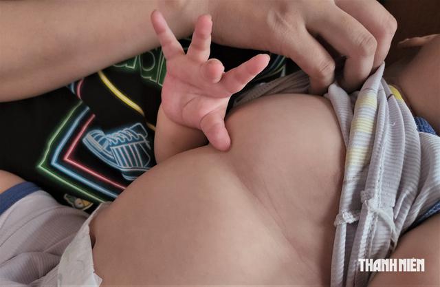 Người mẹ trẻ cầu xin sự gi&uacute;p đỡ v&igrave; con trai mắc bệnh teo cơ tủy sống - Ảnh 2.