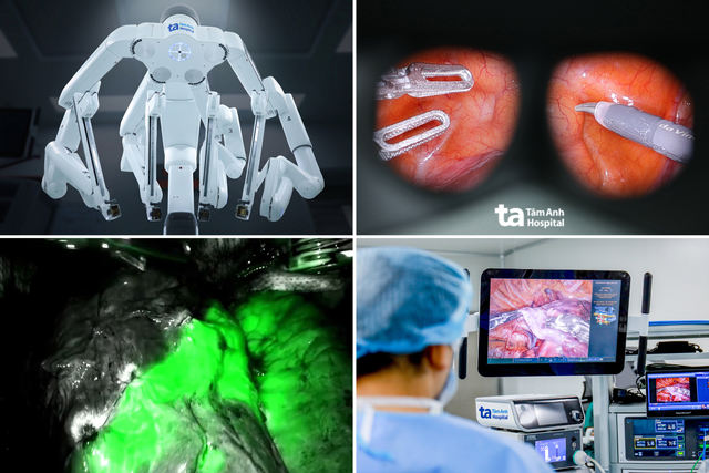 Từ đưa robot về Việt Nam đến l&agrave;m chủ 'c&ocirc;ng nghệ k&eacute;p' tr&ecirc;n Da Vinci Xi (Mỹ) - Ảnh 4.