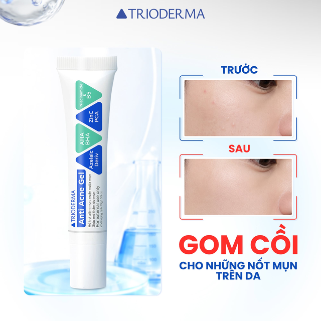 Vì sao mụn không dứt dù skincare đều đặn? Giải pháp cùng dược mỹ phẩm Việt Trioderma- Ảnh 5.
