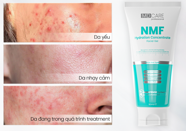 Top 4 hộp kem ‘made in Vietnam’ nâng tầm làn da nên lượt tìm kiếm top đầu - Ảnh 7.