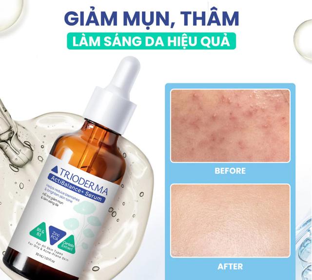 Top 4 hộp kem ‘made in Vietnam’ nâng tầm làn da nên lượt tìm kiếm top đầu - Ảnh 8.