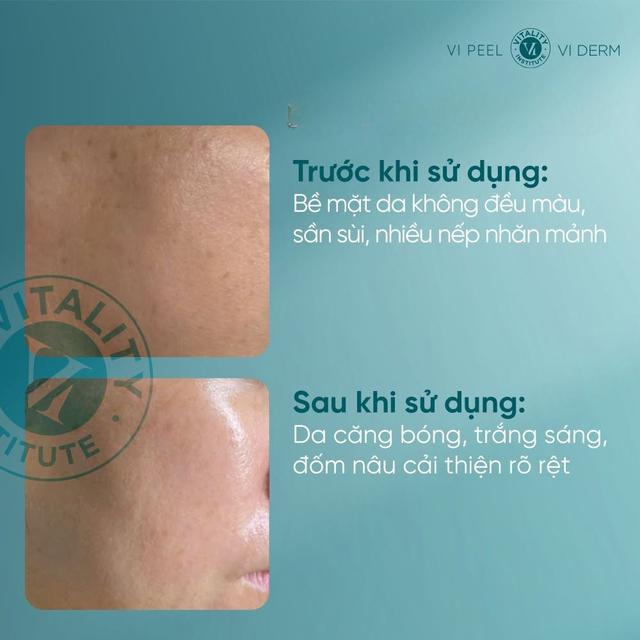 Top 4 kem retinol cho l&agrave;n da tuổi 30+ căng trẻ như chậm lại ở tuổi 20+ - Ảnh 3.