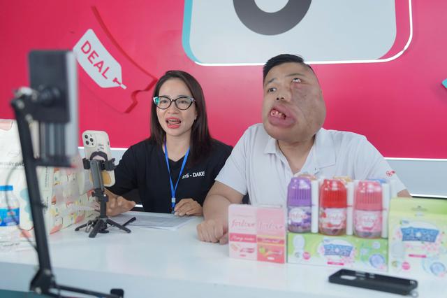 Từ người 'mặt quỷ' thành KOC truyền cảm hứng trên  mạng xã hội- Ảnh 1.