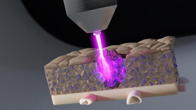 Cảnh b&aacute;o nguy cơ từ thiết bị Plasma gi&aacute; rẻ kh&ocirc;ng đạt chuẩn y khoa- Ảnh 2.