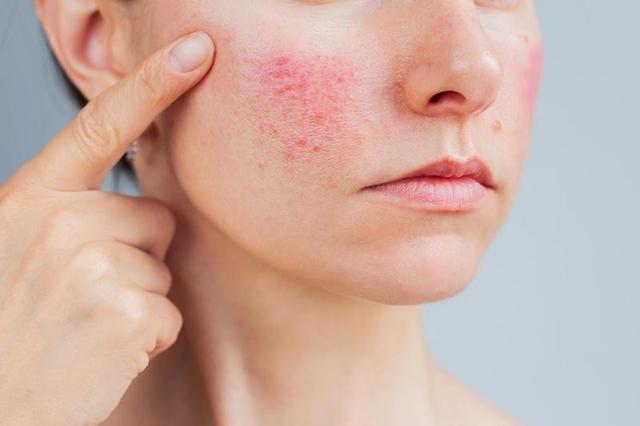 Cảnh b&aacute;o nguy cơ từ thiết bị Plasma gi&aacute; rẻ kh&ocirc;ng đạt chuẩn y khoa- Ảnh 3.