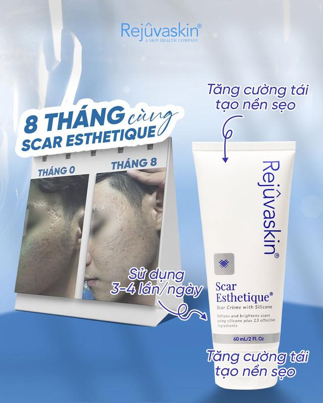 Sẹo mụn và những sai lầm dù đơn giản vẫn khiến việc điều trị mãi không hết- Ảnh 3.