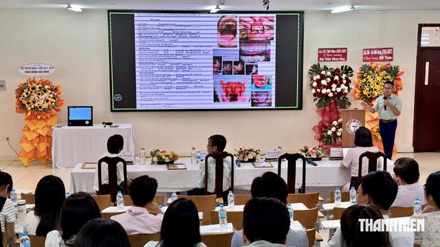 Phẫu thuật mũi có giúp chấm dứt hoàn toàn tiếng ngáy? - Ảnh 1.