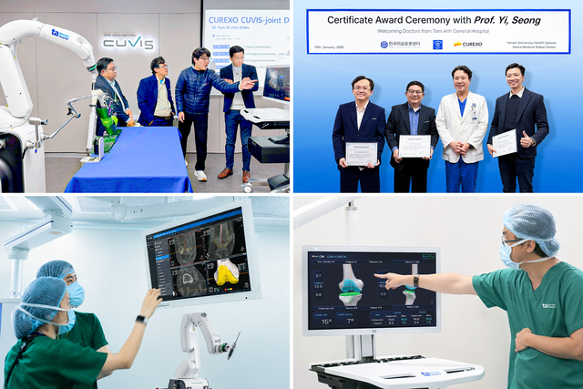 Bệnh viện T&acirc;m Anh 'ph&aacute; kỷ lục' thay khớp phức tạp bằng 'si&ecirc;u robot' AI - Ảnh 5.