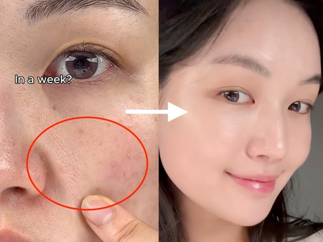 +3 kem retinol khiến chị em giật mình vì da căng bóng glowy, muốn già cũng khó - Ảnh 1.