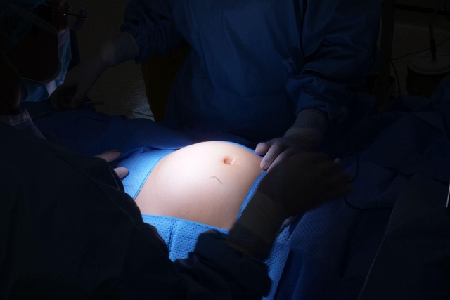 Ngỡ béo bụng, người phụ nữ 30 tuổi phát hiện 28 nhân xơ tử cung - Ảnh 1.