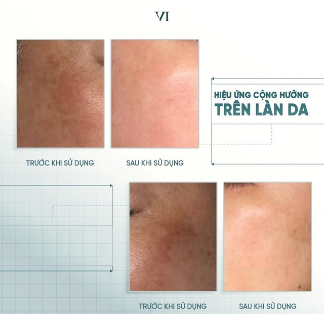 Top 5 kem mờ nám hiệu quả với cả hỗn hợp lâu năm, hết hàng liên tục - Ảnh 7.