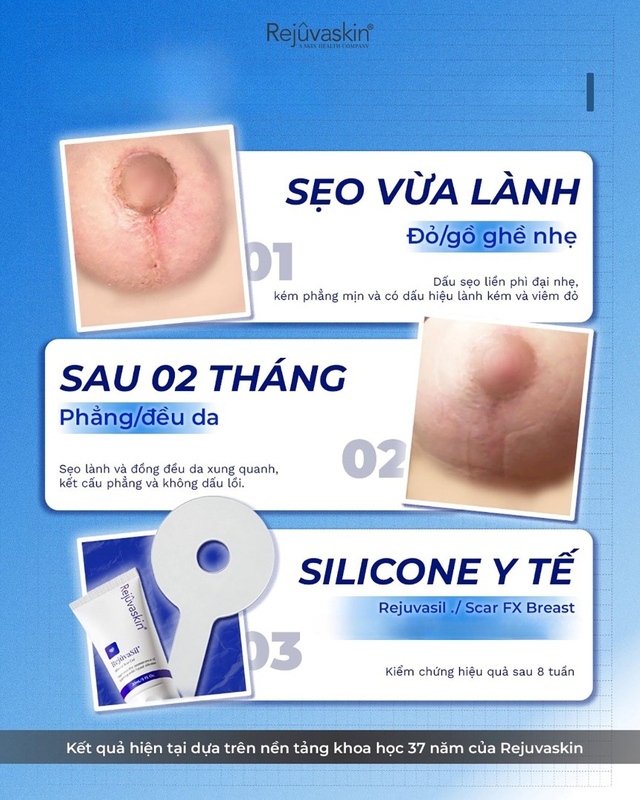Cách dùng miếng dán ngừa sẹo mổ chuẩn y khoa da láng mịn sau khoảng 4 tuần - Ảnh 3.