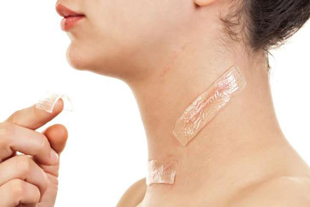 Cách dùng miếng dán ngừa sẹo mổ chuẩn y khoa da láng mịn sau khoảng 4 tuần - Ảnh 6.