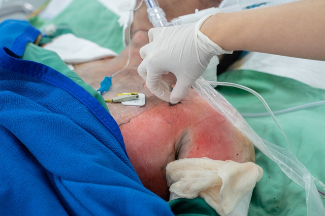 Vụ ch&aacute;y nh&agrave; ở TP.HCM: Chuyển 5 người bị bỏng đến 2 bệnh viện - Ảnh 1.