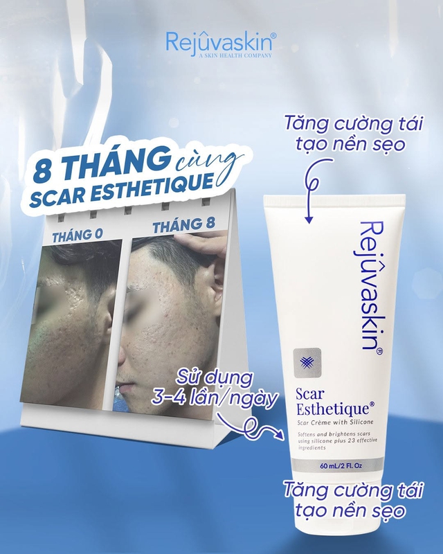 Kem mờ sẹo rỗ nào hiệu quả với cả sẹo lâu năm mà không cần xâm lấn? - Ảnh 8.