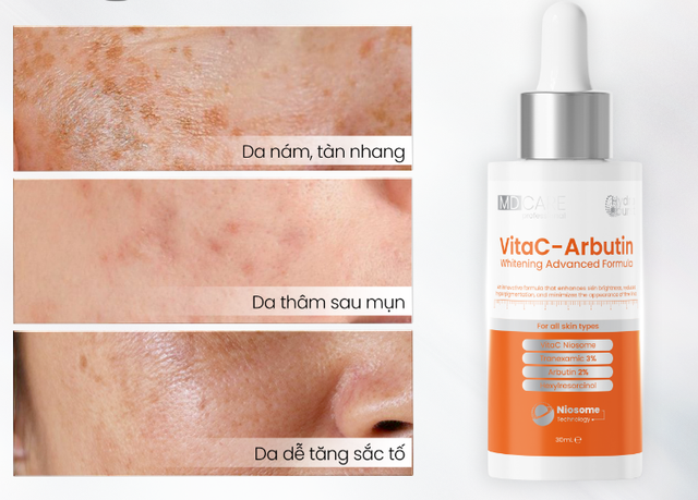 U.35+ muốn trông trẻ hơn thì đừng quên +3 serum collagen cho da căng trẻ glowy- Ảnh 3.