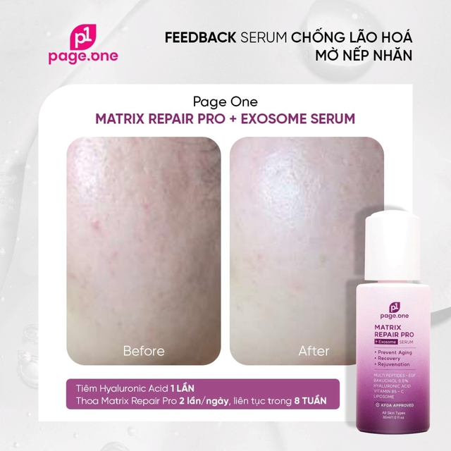 U.35+ muốn trông trẻ hơn thì đừng quên +3 serum collagen cho da căng trẻ glowy- Ảnh 7.