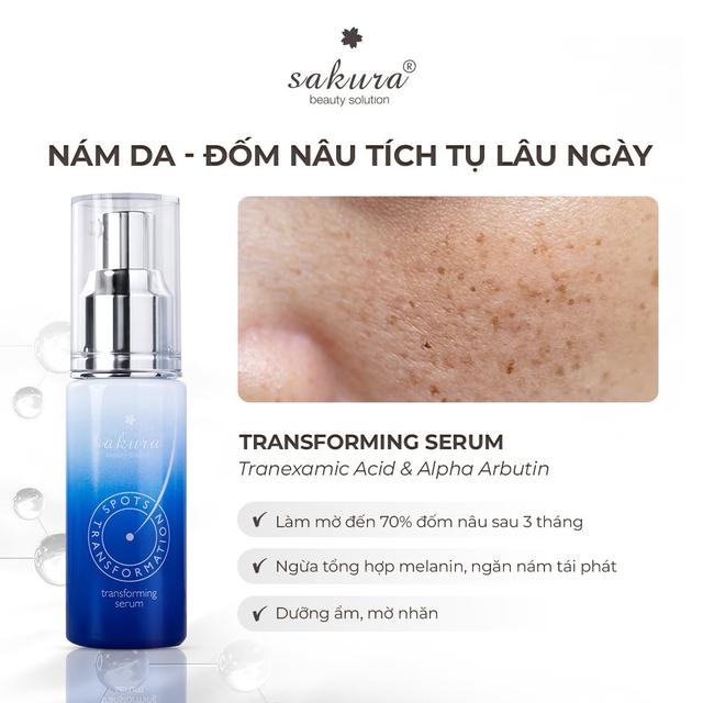 +5 serum mờ nám mảng, nám chân sâu; hiệu quả cả nám lâu năm không xâm lấn - Ảnh 2.