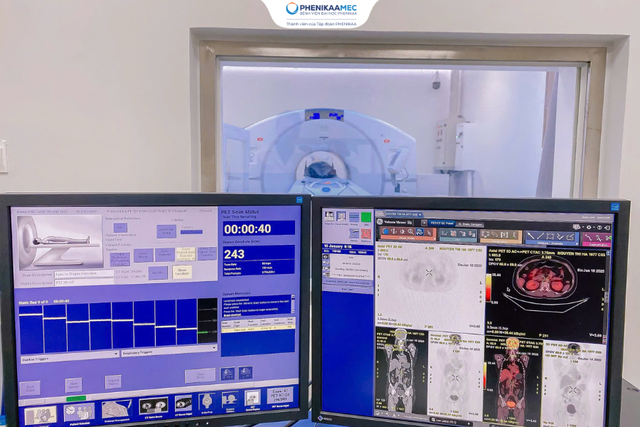 Chụp PET/CT c&oacute; an to&agrave;n kh&ocirc;ng? Chuy&ecirc;n gia ung bướu giải đ&aacute;p - Ảnh 4.