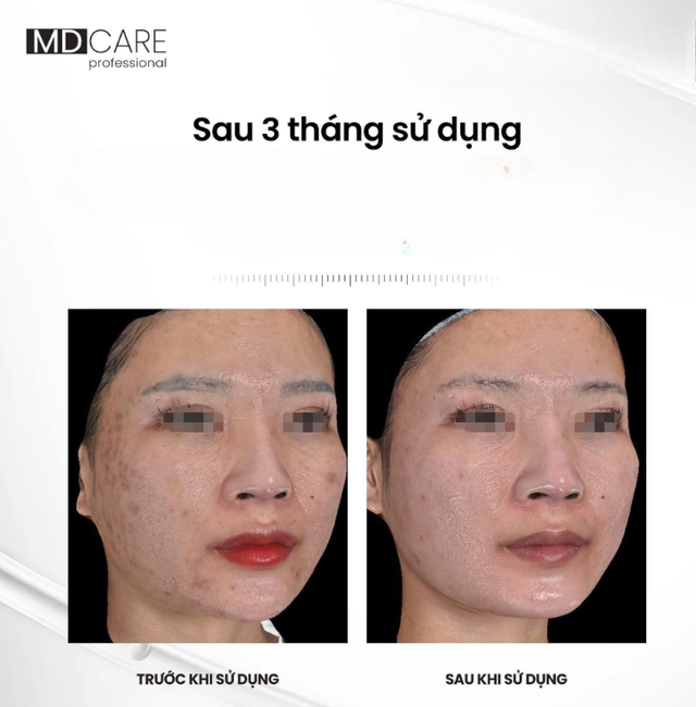 +5 serum mờ nám mảng, nám chân sâu; hiệu quả cả nám lâu năm không xâm lấn - Ảnh 5.