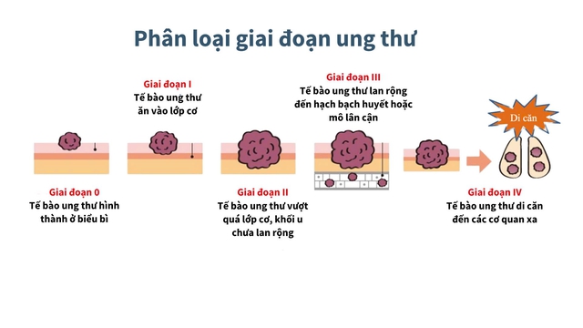 Hai năm kh&ocirc;ng đi t&aacute;i kh&aacute;m, người phụ nữ ph&aacute;t hiện tổn thương tiền ung thư - Ảnh 3.