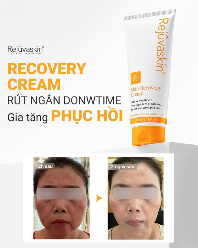 Kem dưỡng ẩm hỗ trợ phục hồi da sau peel, laser nào được chuyên gia tin dùng? - Ảnh 10.