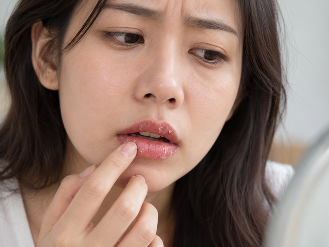 4 biểu hiện trên môi do cơ thể thiếu chất, mắc bệnh - Ảnh 1.