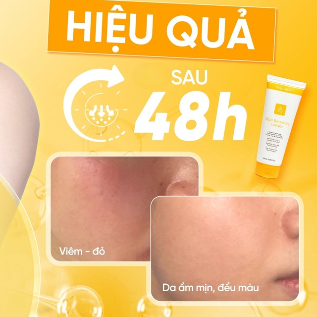 Kem dưỡng ẩm hỗ trợ phục hồi da sau peel, laser nào được chuyên gia tin dùng? - Ảnh 8.