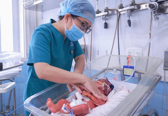 Bé sinh non mắc bệnh vảy cá hiếm gặp, hồi phục sau 12 ngày điều trị - Ảnh 2.