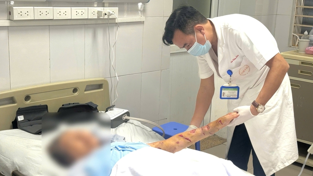 Cẩn trọng khi nh&agrave; c&oacute; ch&oacute; nu&ocirc;i con - Ảnh 1.