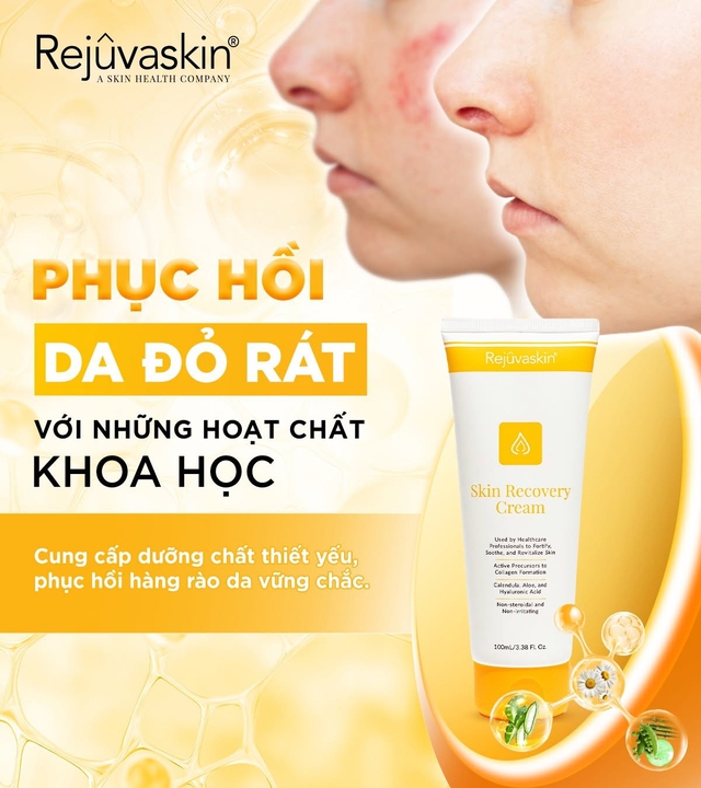 +5 kem dưỡng ẩm cho da kh&ocirc; r&aacute;p, nứt nẻ cũng căng mịn &lsquo;glowy&rsquo; hơn mỗi ng&agrave;y- Ảnh 5.