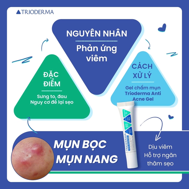 Bất ngờ kem giảm mụn tuổi dậy thì được phụ huynh tìm mua nhiều ‘made in VietNam’ - Ảnh 4.