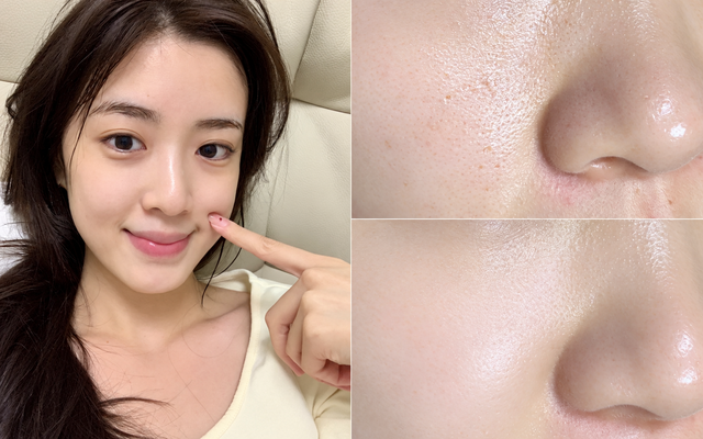 Da 40+ muốn căng bóng như tuổi 25: +5 serum chống lão hóa giúp da căng bóng - Ảnh 1.