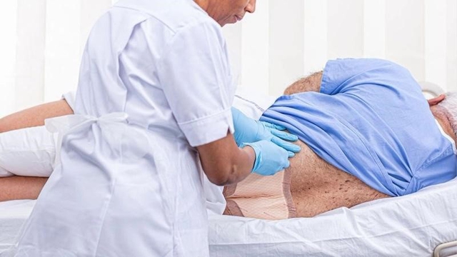 Chống lo&eacute;t t&igrave; đ&egrave; cho người nằm l&acirc;u: Ph&ograve;ng ngừa sớm để vơi g&aacute;nh nặng chăm s&oacute;c- Ảnh 2.