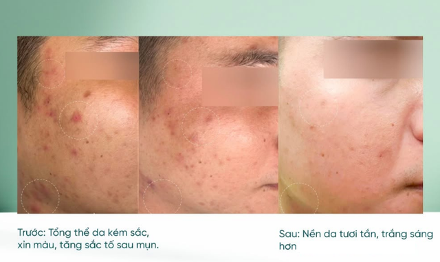 Da 40+ muốn căng bóng như tuổi 25: +5 serum chống lão hóa giúp da căng bóng - Ảnh 7.