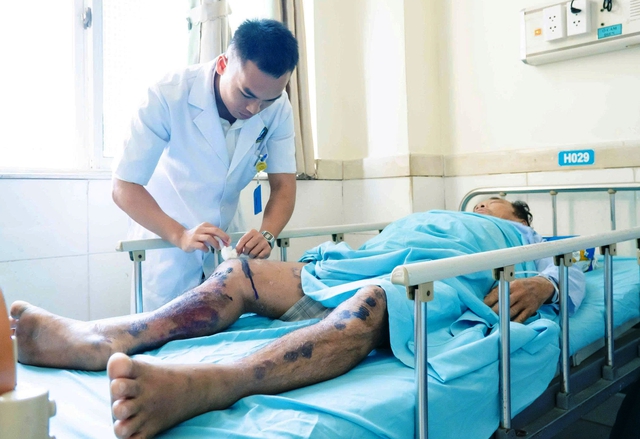 Sau hành trình sinh tử trên biển, 3 ngư dân tiếp tục điều trị tại bệnh viện - Ảnh 1.