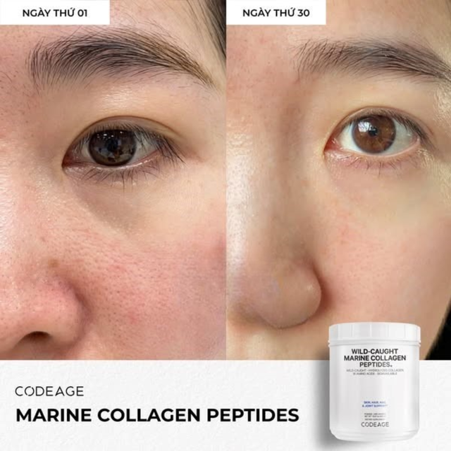 Nên bổ sung collagen từ tuổi bao nhiêu? Từ 20 tuổi liệu có trẻ quá không?- Ảnh 5.