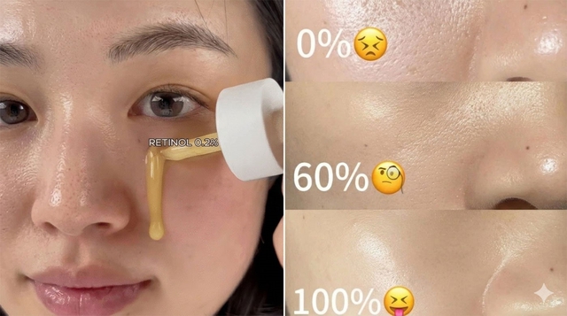 Cách dùng retinol giúp da căng bóng, mờ nám không bong tróc dù da nhạy cảm- Ảnh 4.
