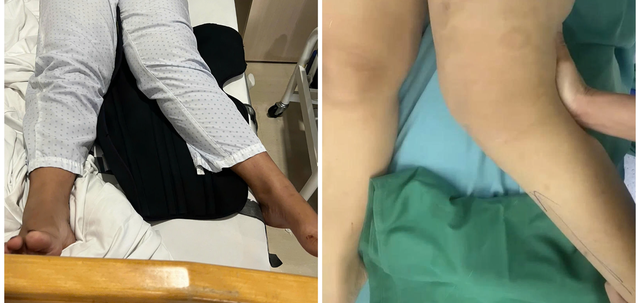 Đứt 3 d&acirc;y chằng, vượt h&agrave;ng trăm c&acirc;y số t&igrave;m lại bước đi - Ảnh 1.