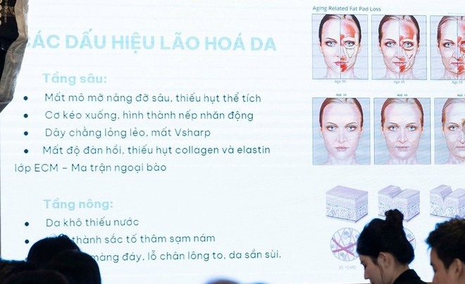 Liệu pháp peel da an toàn được chuyên gia tin tưởng, thay thế filler và botox- Ảnh 3.