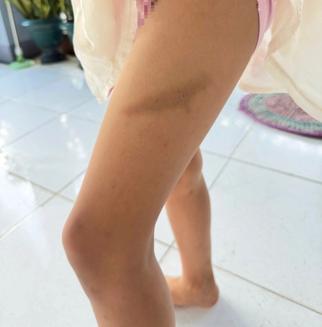 Giáo viên đánh học sinh làm sai bài tập: Tranh luận chuyện đòn roi trong giáo dục - Ảnh 2.