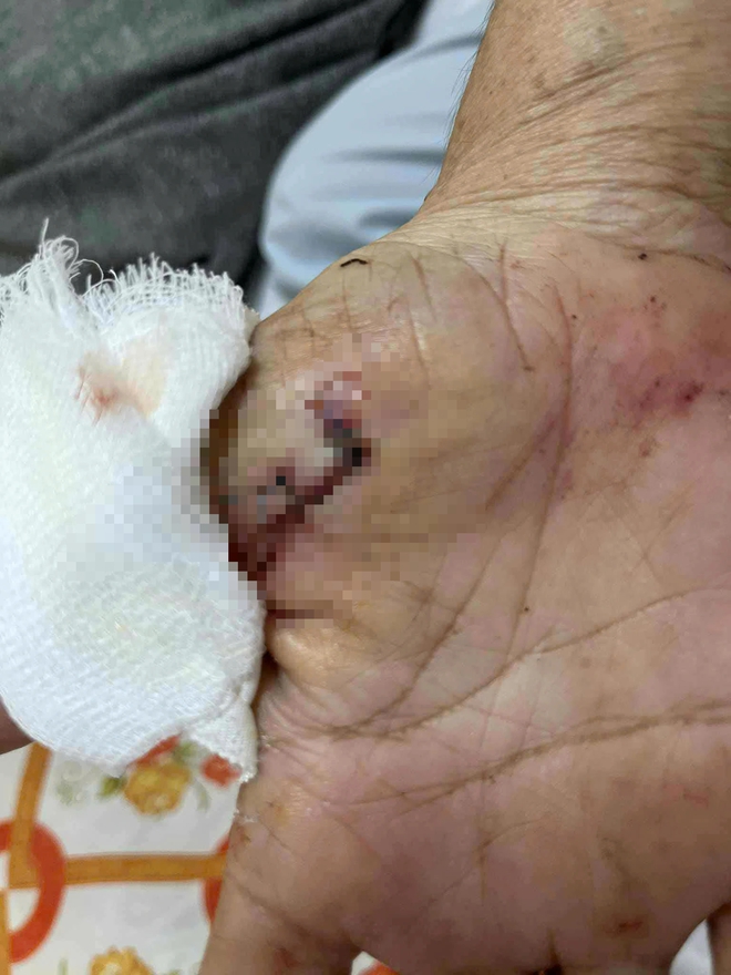 Điều tra vụ người phụ nữ bị tấn công bằng hung khí khi đang tập thể dục - Ảnh 8.