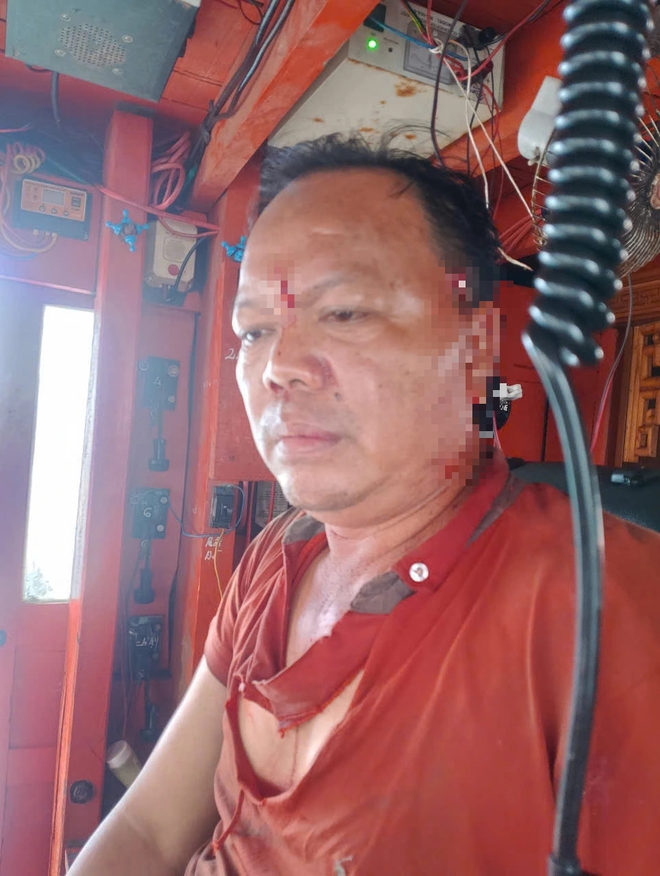 Thuyền trưởng bị tấn công trên biển Vũng Tàu: Hành vi bạo lực đáng báo động - Ảnh 2.
