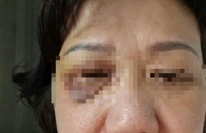 TP.HCM: 2 vợ chồng trẻ hành hung người phụ nữ 60 tuổi tại sảnh chung cư- Ảnh 1. TP.HCM: 2 vợ chồng trẻ hành hung người phụ nữ 60 tuổi tại sảnh chung cư- Ảnh 1.