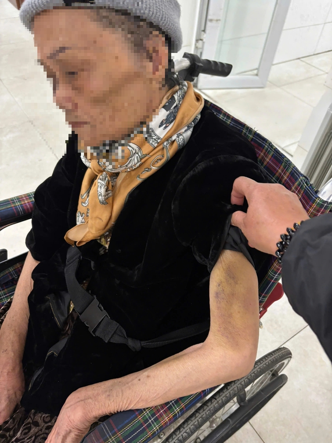 Công an điều tra vụ nữ giúp việc bạo hành cụ bà 82 tuổi ở Hà Nội- Ảnh 1. Công an điều tra vụ nữ giúp việc bạo hành cụ bà 82 tuổi ở Hà Nội- Ảnh 1.