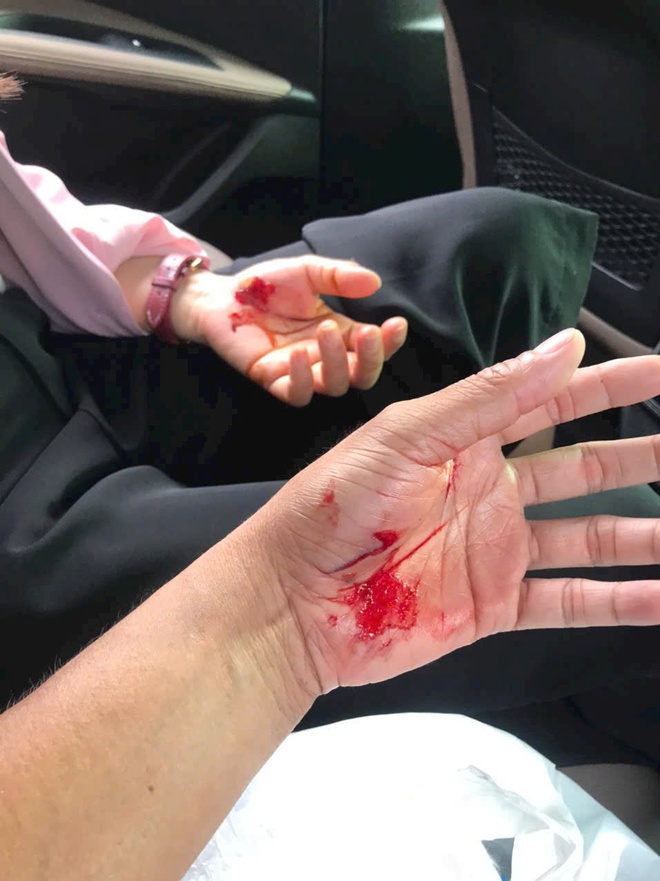 Nỗi ám ảnh mang tên chó thả rông- Ảnh 4. Nỗi ám ảnh mang tên chó thả rông- Ảnh 4.