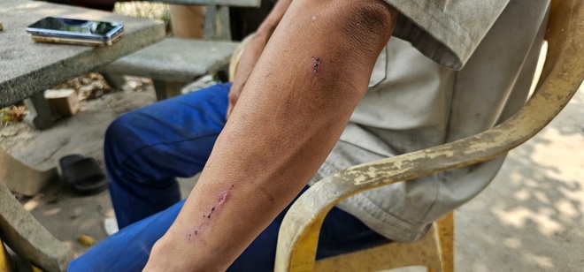 Chủ gara ở Củ Chi tố bị hàng xóm hành hung sau khi hỏi tiền sửa xe- Ảnh 3. Chủ gara ở Củ Chi tố bị hàng xóm hành hung sau khi hỏi tiền sửa xe- Ảnh 3.