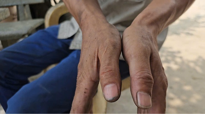 Chủ gara ở Củ Chi tố bị hàng xóm hành hung sau khi hỏi tiền sửa xe- Ảnh 4. Chủ gara ở Củ Chi tố bị hàng xóm hành hung sau khi hỏi tiền sửa xe- Ảnh 4.