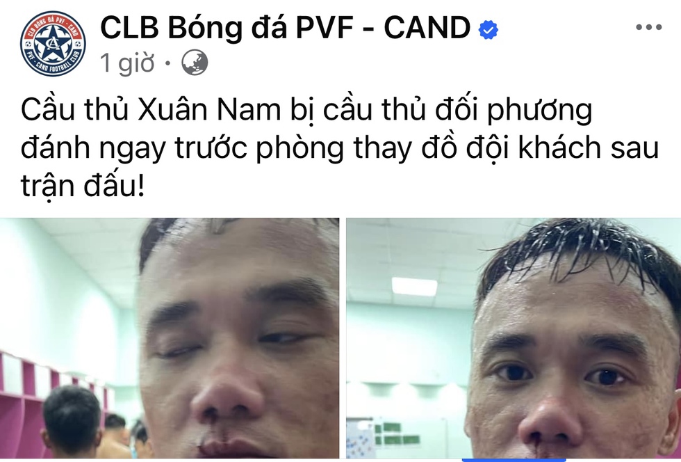 Thực hư vụ Xuân Nam bị đánh đến đổ máu ngay trước phòng thay đồ- Ảnh 1.