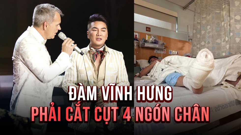 Ca sĩ Đàm Vĩnh Hưng đổi luật sư, xác nhận việc ‘mất 4 ngón chân’- Ảnh 1.